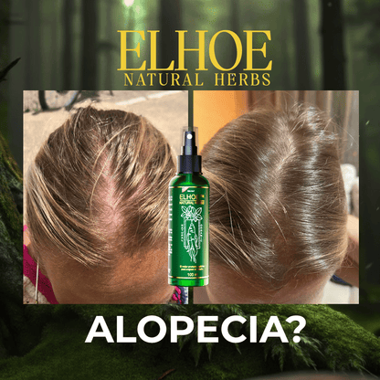 ELHOE - Crecimiento del Cabello